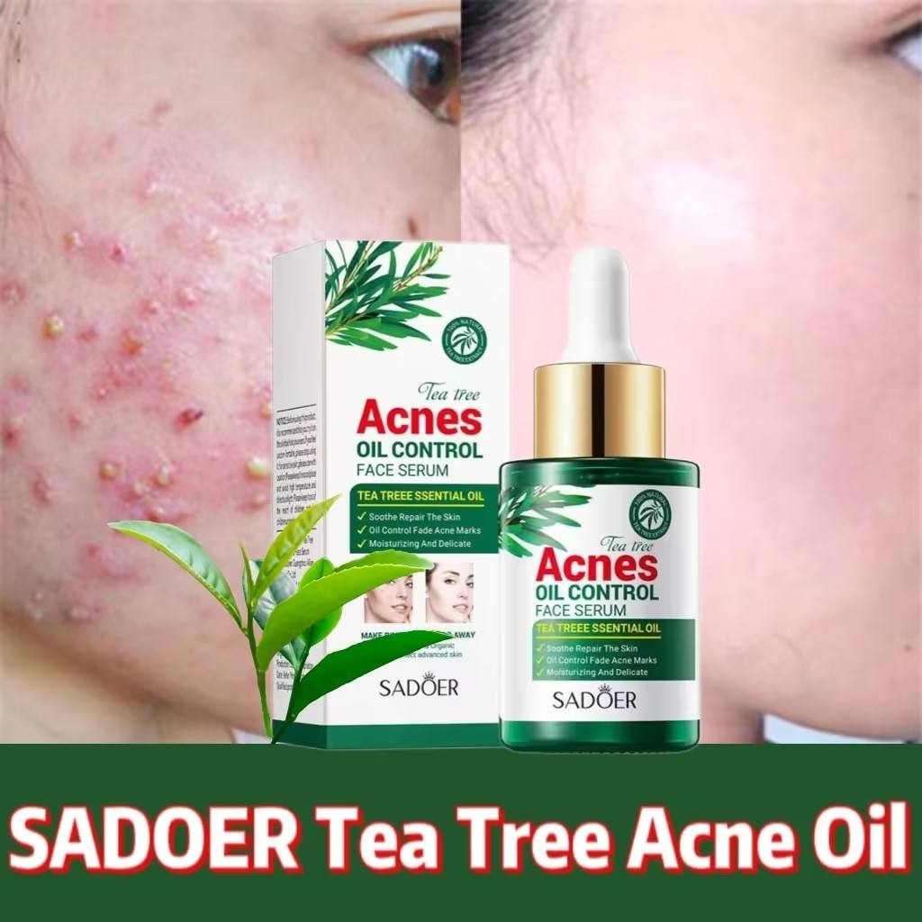 سرم ضدجوش درخت چای سادور 30 میل سرم مناسب پوست چرب و مستعد جوش