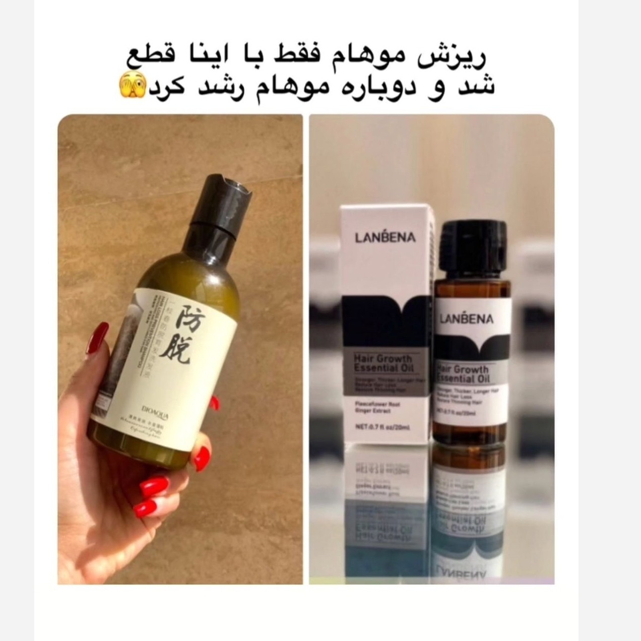 پک رویش مو پک ضدریزش مو (شامپو رزماری و قطره ضدریزش لانبنا)